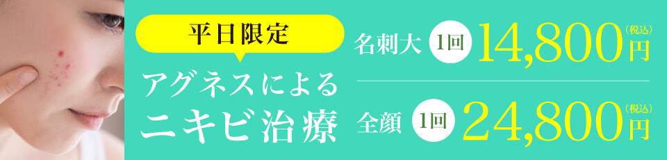平日限定アグネスによるニキビ治療