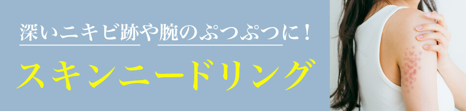 スキンニードリング