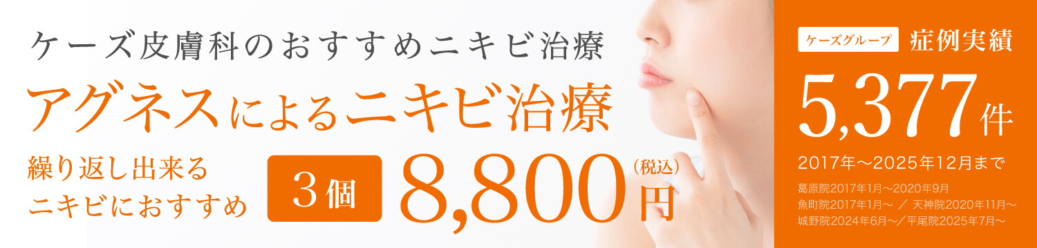 アグネスニキビ