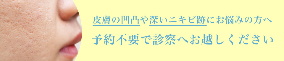 サブシジョンは予約不要